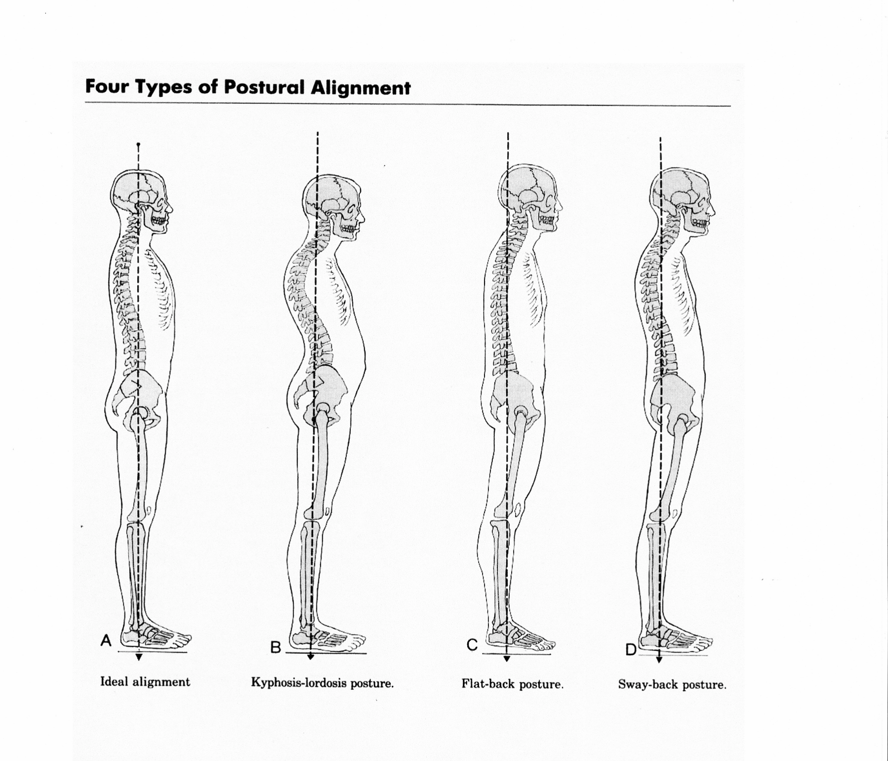 What is Posture and How to Improve Your Posture