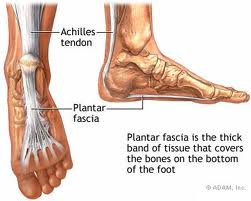 Picture of the achilles tendon wrapping around the calcaneus and blending into the plantar fascia. Plantar fasciitis.